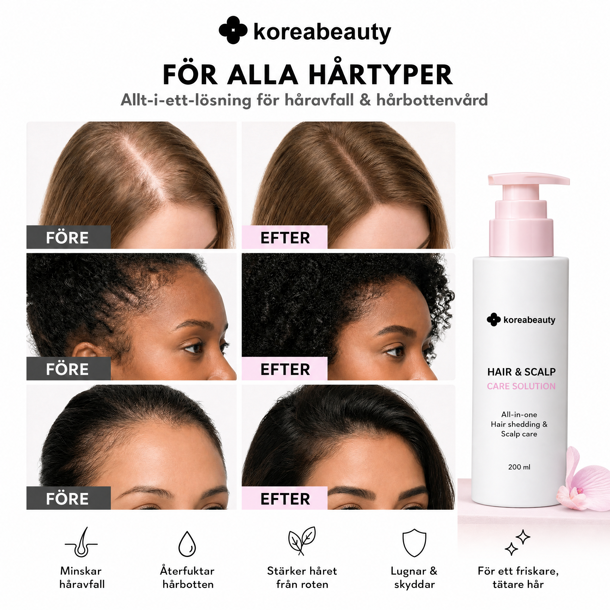 Koreabeauty - koreas bästa hårväxtserum