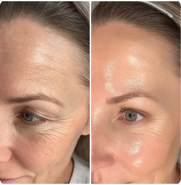 PDRN+ Kollagen +peptid wrapping mask