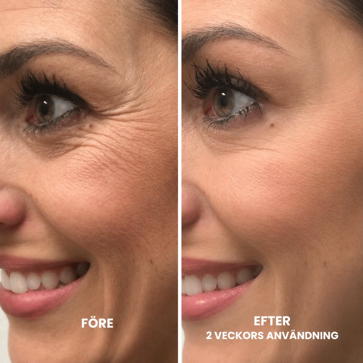 Retinal Booster - koreas hemlighet till jämnare hud